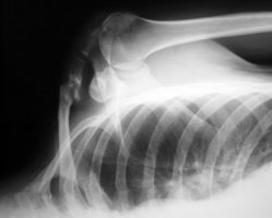 xray xray